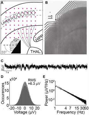 Isolation of the murine Glut1 deficient thalamocortical circuit: wavelet characterization and reverse glucose dependence of low and gamma frequency oscillations